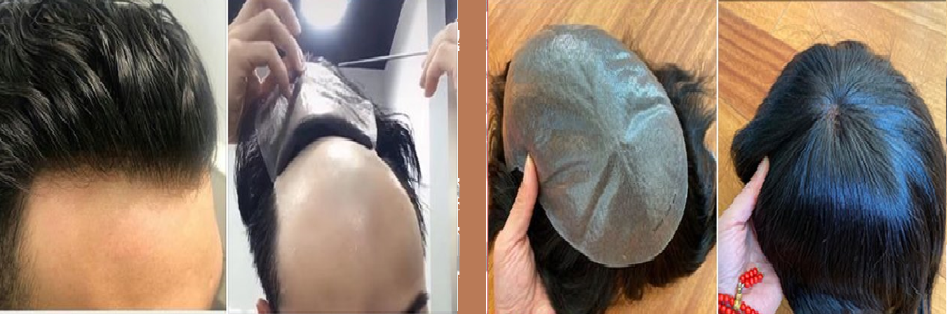 Hair Weaving Service in Ghaziabad - The Hair Solution